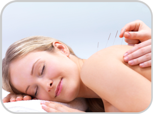 acupuncture: woman with needles